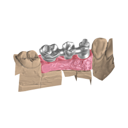 Módulo de Implantes